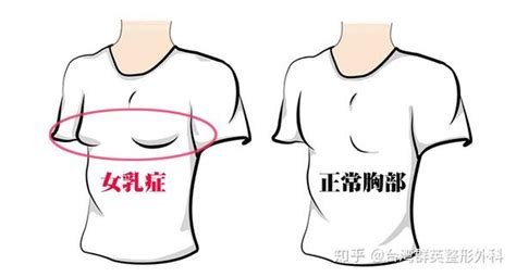 女人的乳頭|形状一人一样 女性乳头的12个秘密